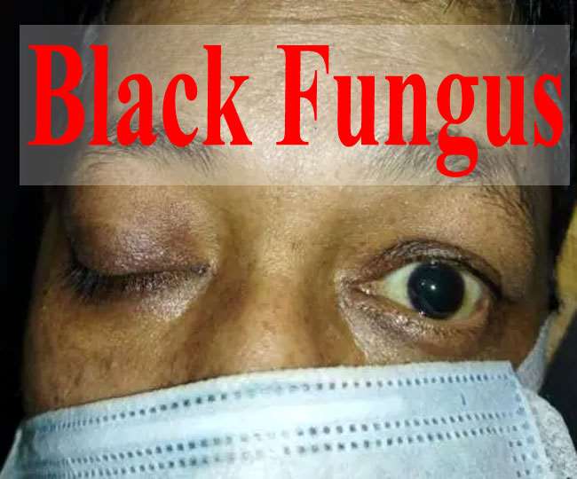 black-fungus.jpg